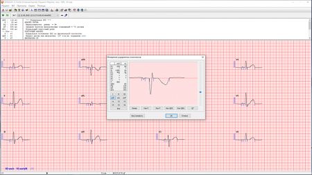 Программный модуль анализа ЭКГ покоя «ArMaSoft-12-Cardio»