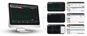 Программа управления данными ЭКГ Smart ECG Viewer